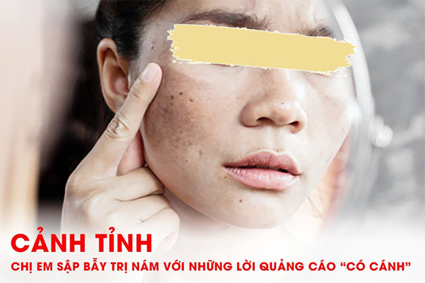 CẢNH TỈNH CHỊ EM SẬP BẪY TRỊ NÁM VỚI NHỮNG LỜI QUẢNG CÁO “CÓ CÁNH”